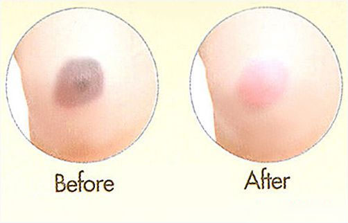 Mỹ phẩm Kem làm hồng nhũ hoa Mayfair Pink Nipple - Photo 5 Kem làm hồng nhũ hoa Mayfair Pink Nipple - Photo 5