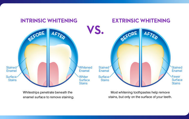 Mỹ phẩm Kem đánh răng Colgate Tartar Protection Whitening - Photo 4 Mỹ phẩm Kem đánh răng Colgate Tartar Protection Whitening - Photo 4
