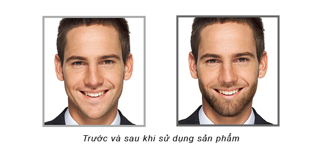 Mỹ phẩm Thuốc mọc râu Vacosi SK|Color - Photo 4 Thuốc mọc râu Vacosi SK|Color - Photo 4