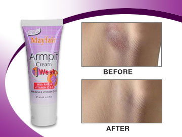 Mỹ phẩm Kem làm trắng nách và khử mùi hôi Mayfair Armpit Cream - Photo 6 Kem làm trắng nách và khử mùi hôi Mayfair Armpit Cream - Photo 6