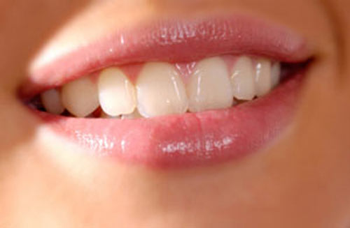 Trang điểm Son dưỡng Fran Wilson Aloe Lip Care - Photo 6 Son dưỡng Fran Wilson Aloe Lip Care - Photo 6