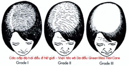 Sản phẩm Tóc Dầu Gội Mọc Tóc Petrole Hahn - Photo 4 Dầu Gội Mọc Tóc Petrole Hahn - Photo 4