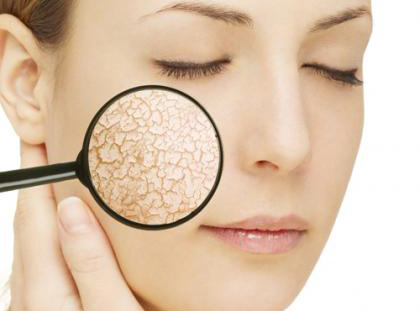 Mỹ phẩm Kem đặc trị mụn Avene TriAcneal - Photo 4 Kem đặc trị mụn Avene TriAcneal - Photo 4