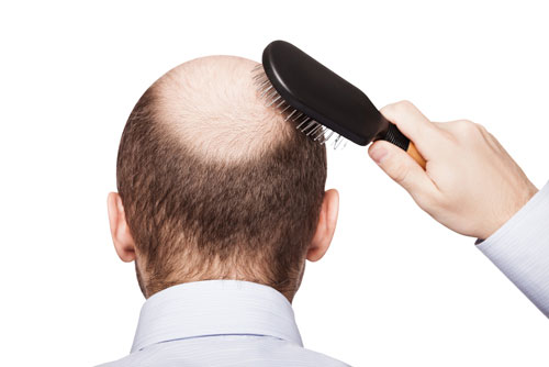 Sản phẩm Tóc Thuốc mọc tóc Kaminomoto Hair Growth Accelerator nâu đậm - Photo 5 Thuốc mọc tóc Kaminomoto - Photo 5